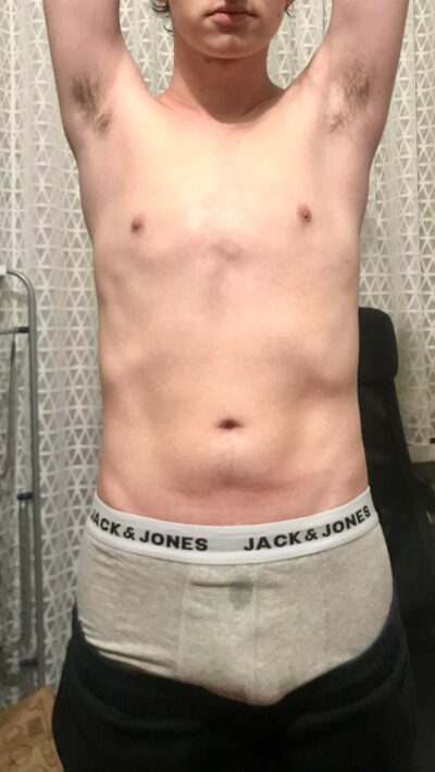 Boy Pits in Jack & Jones Boxer Briefs
